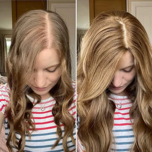 Real Folixir customer: scalp and hair density before and after consistent use