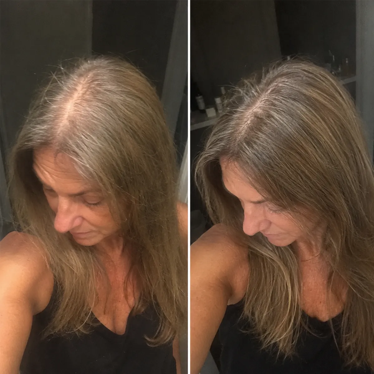 Real Folixir customer: widening part and visible scalp before and after consistent use