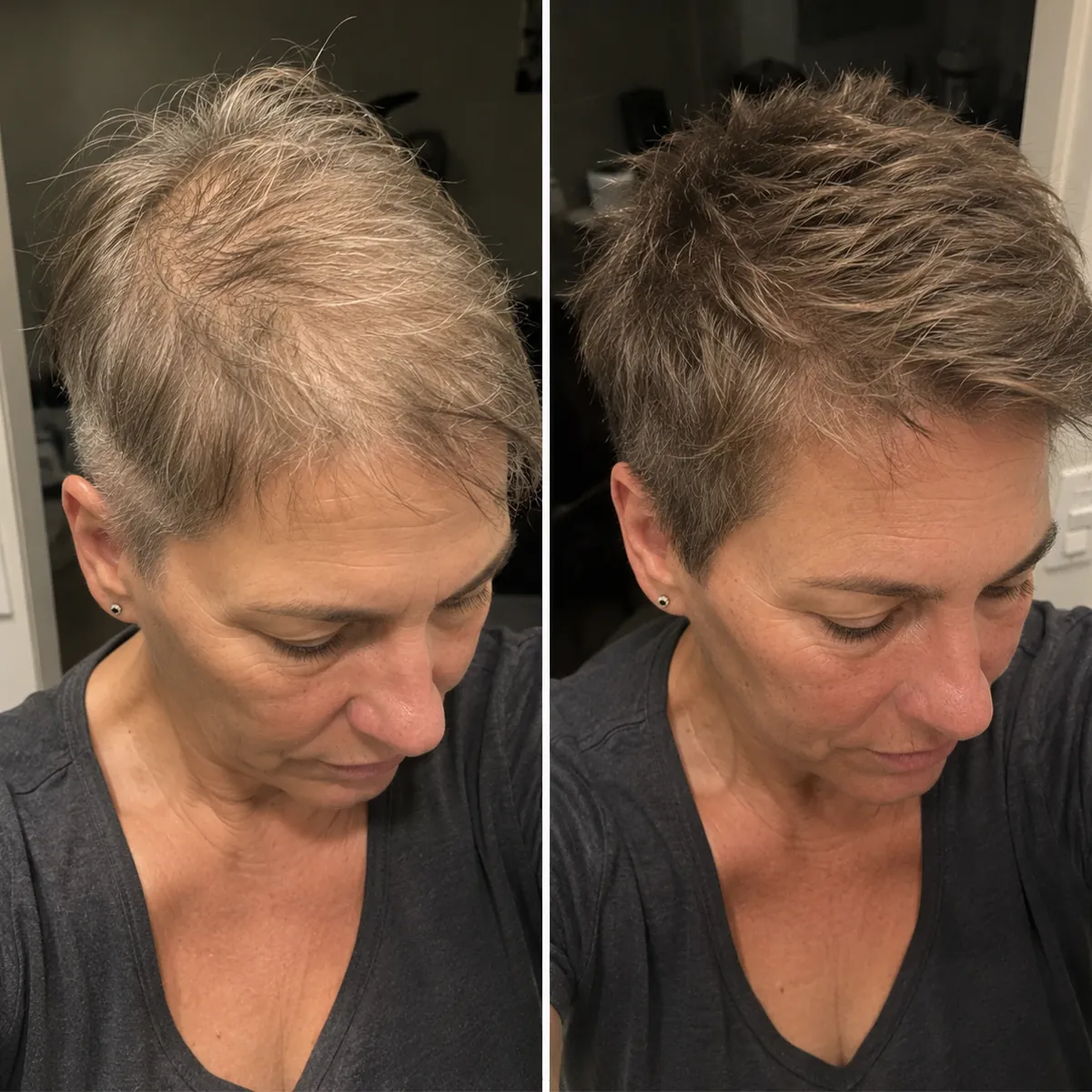 Real Folixir customer aged 40–50 with short hair: crown density before and after consistent use
