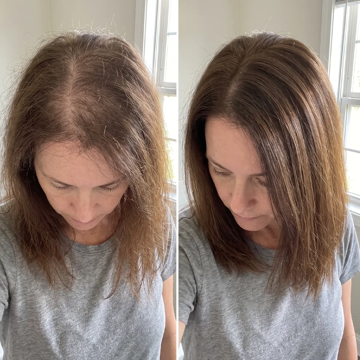 Real Folixir customer aged 40–50: part and crown before and after consistent use