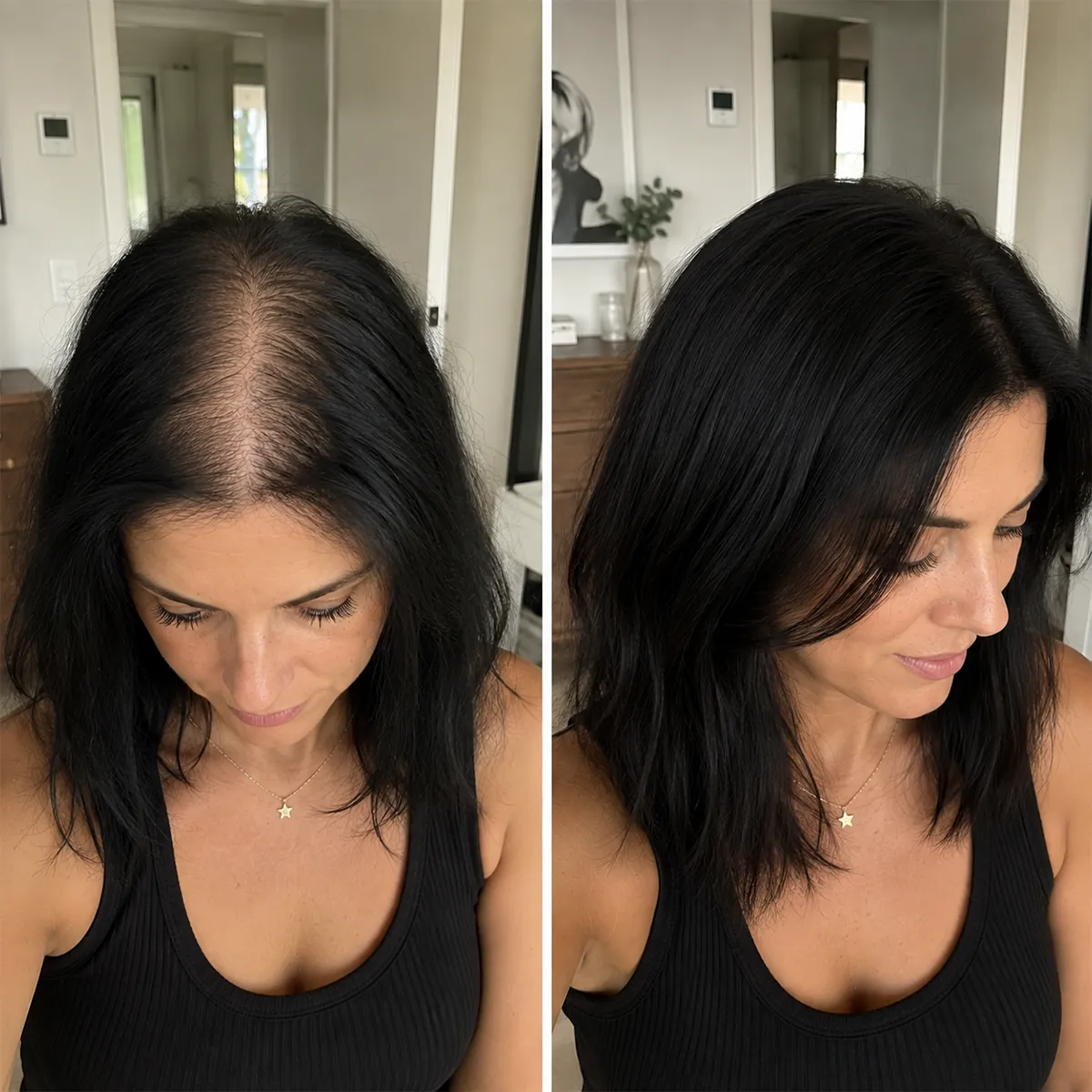 Real Folixir customer aged 30–40: part and scalp visibility before and after consistent use